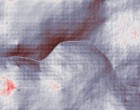 lymphdrainage fortbildung